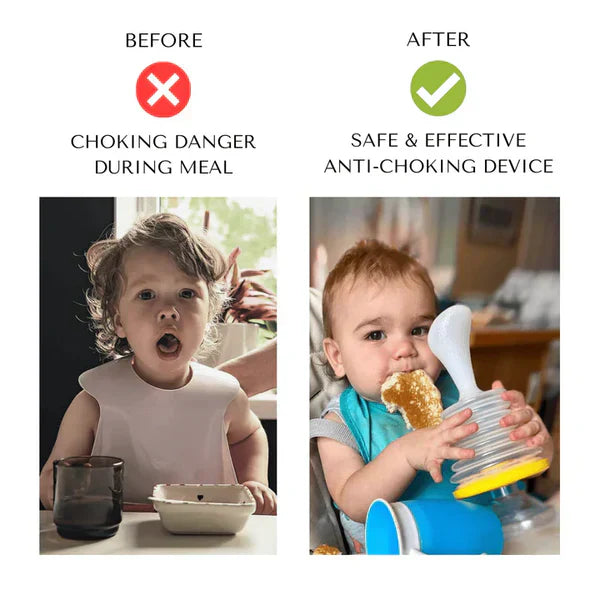 TopNext™ ANTI-CHOKING DEVICE