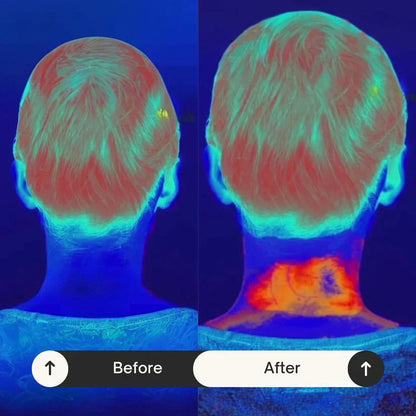 TopNext™ - Neck Massager